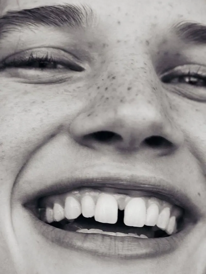 Black and white close-up of a wide smile with a gap between the front teeth
